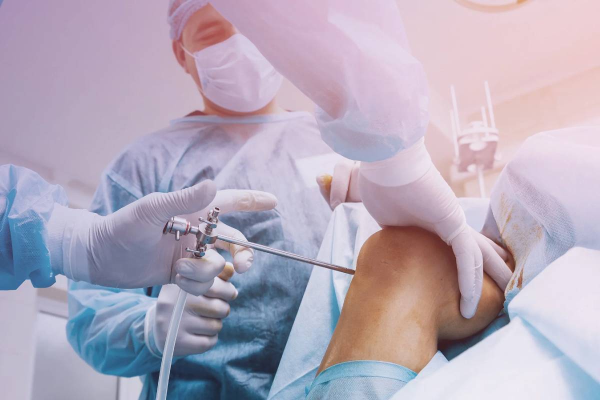 Knee arthroscopy procedure