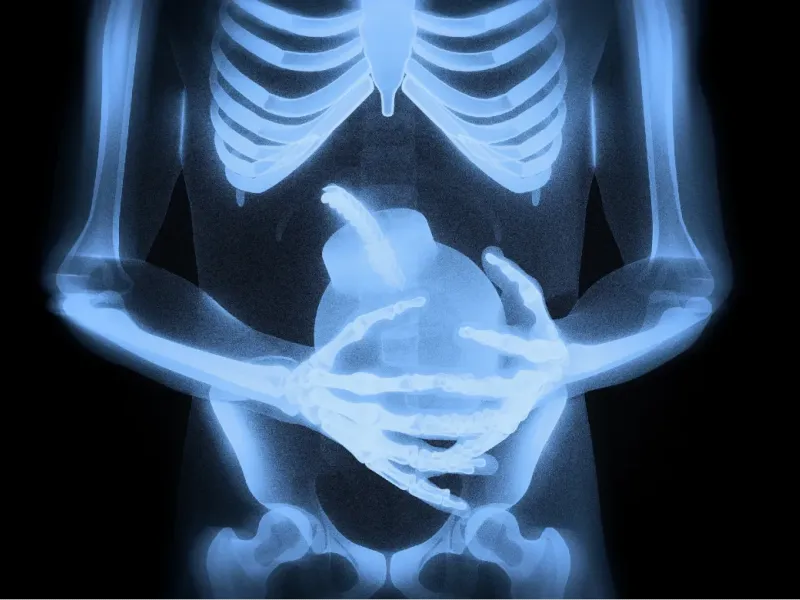 Knee X-ray imaging