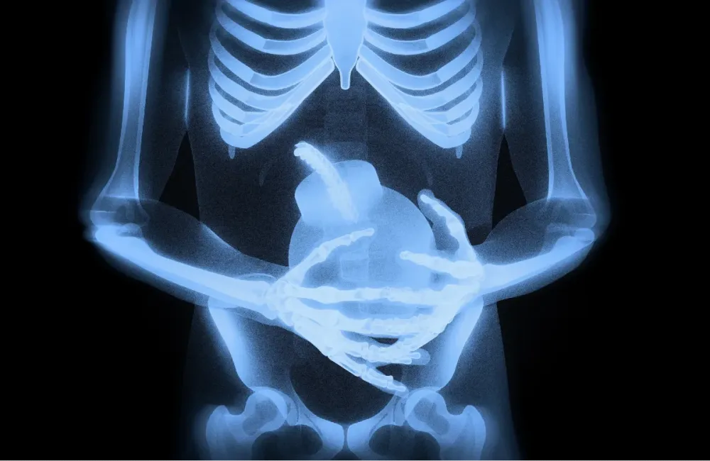 Knee X-ray imaging