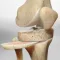 Illustration of a knee showing bone alignment