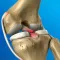 Illustration of the ligaments inside a knee joint
