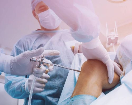 Knee arthroscopy procedure