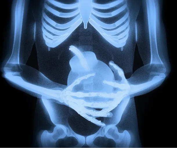 Knee X-ray imaging